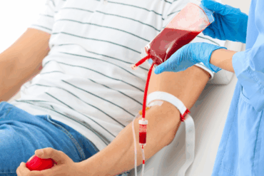 Rwa Kulszowa a Terapia Bańkami Chińskimi